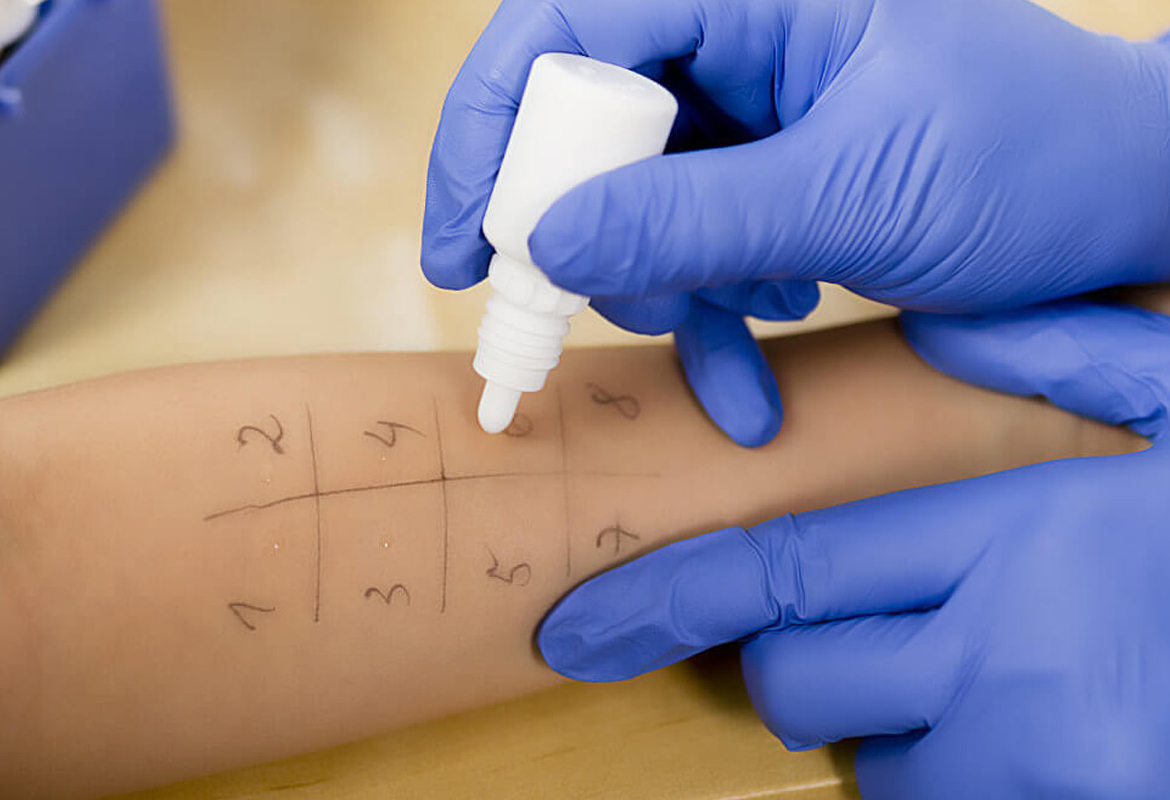 allergologia convenzionata